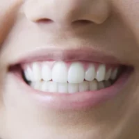 Jakie są najważniejsze zalecenia po zabiegu skalingu, aby utrzymać efekty na dłużej?